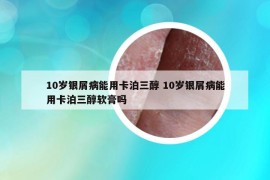 10岁银屑病能用卡泊三醇 10岁银屑病能用卡泊三醇软膏吗