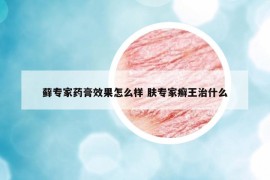 藓专家药膏效果怎么样 肤专家癣王治什么