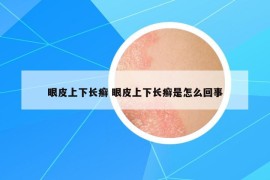 眼皮上下长癣 眼皮上下长癣是怎么回事