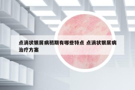 点滴状银屑病初期有哪些特点 点滴状银屑病治疗方案