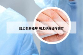 腿上张藓还痒 腿上张藓还痒偏方