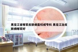 黑龙江省哪家皮肤病是权威专科 黑龙江治皮肤病哪家好