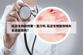 拓咨生物制剂要一直打吗 拓咨生物制剂明年会进医保吗?