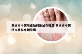 重庆市中医院皮肤科地址在哪里 重庆市中医院皮肤科电话号码