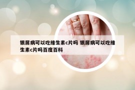 银屑病可以吃维生素c片吗 银屑病可以吃维生素c片吗百度百科