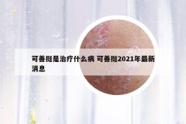 可善挺是治疗什么病 可善挺2021年最新消息