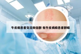 牛皮癣患者交流微信群 有牛皮病癣患者群嘛