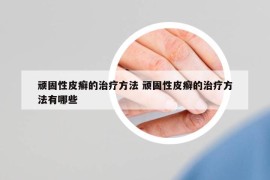 顽固性皮癣的治疗方法 顽固性皮癣的治疗方法有哪些