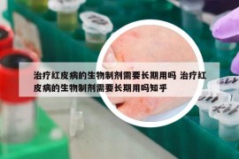 治疗红皮病的生物制剂需要长期用吗 治疗红皮病的生物制剂需要长期用吗知乎