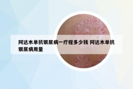 阿达木单抗银屑病一疗程多少钱 阿达木单抗银屑病用量