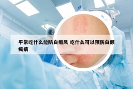 平常吃什么能防白癜风 吃什么可以预防白颠疯病