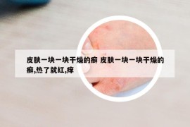 皮肤一块一块干燥的癣 皮肤一块一块干燥的癣,热了就红,痒