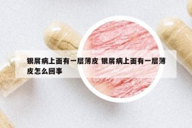 银屑病上面有一层薄皮 银屑病上面有一层薄皮怎么回事