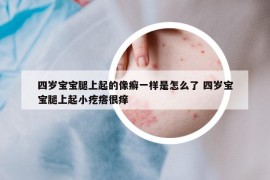 四岁宝宝腿上起的像癣一样是怎么了 四岁宝宝腿上起小疙瘩很痒