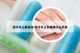 孩子手上癣咨询 孩子手上长癣用什么药膏