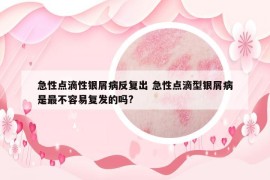 急性点滴性银屑病反复出 急性点滴型银屑病是最不容易复发的吗?