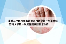 皮肤三甲医院哪家最好苏州大学第一院皮肤科 苏州大学第一附属医院皮肤科怎么样