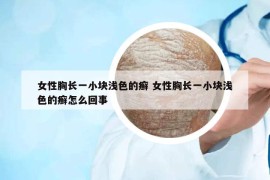 女性胸长一小块浅色的癣 女性胸长一小块浅色的癣怎么回事