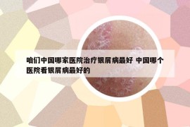 咱们中国哪家医院治疗银屑病最好 中国哪个医院看银屑病最好的