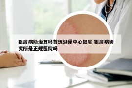 银屑病能治愈吗首选迎泽中心银屑 银屑病研究所是正规医院吗