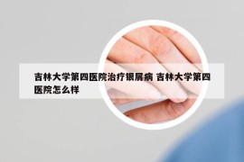 吉林大学第四医院治疗银屑病 吉林大学第四医院怎么样