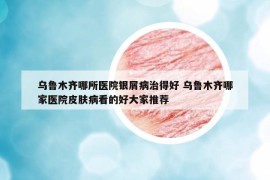 乌鲁木齐哪所医院银屑病治得好 乌鲁木齐哪家医院皮肤病看的好大家推荐