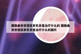 醋酸曲安奈德尿素乳膏是治疗什么的 醋酸曲安奈德尿素乳膏是治疗什么的图片