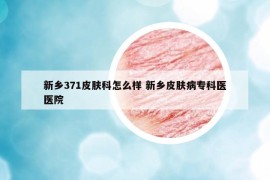 新乡371皮肤科怎么样 新乡皮肤病专科医医院