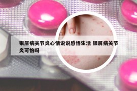 银屑病关节炎心情说说感悟生活 银屑病关节炎可怕吗