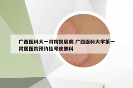 广西医科大一附院银屑病 广西医科大学第一附属医院预约挂号皮肤科