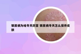 银屑病为啥冬天厉害 银屑病冬天怎么保养皮肤