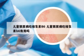 儿童银屑病吃维生素B6 儿童银屑病吃维生素b6有用吗