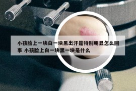 小孩脸上一块白一块黑出汗是特别明显怎么回事 小孩脸上白一块黑一块是什么