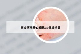 西安医院看白癜风39健康问答