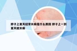 脖子上夏天经常长癣是什么原因 脖子上一到夏天就长癣