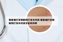 银屑病打生物制剂打多长时间 银屑病打生物制剂打多长时间才能停药呢