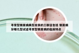 寻常型银屑病典型皮损的三联征包括 银屑病分哪几型试述寻常型银屑病的临床特点