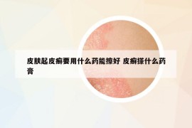 皮肤起皮癣要用什么药能擦好 皮癣搽什么药膏