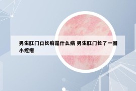 男生肛门口长癣是什么病 男生肛门长了一圈小疙瘩