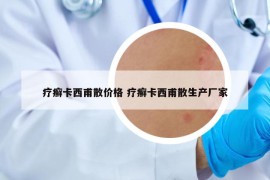 疗癣卡西甫散价格 疗癣卡西甫散生产厂家