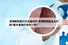 生物制剂是打针还是吃药 生物制剂是怎么打的?是不是像打吊针一样?