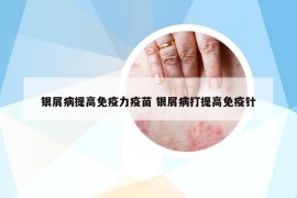 银屑病提高免疫力疫苗 银屑病打提高免疫针