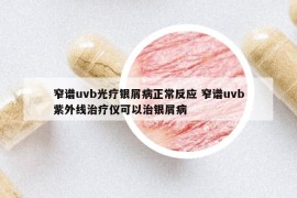 窄谱uvb光疗银屑病正常反应 窄谱uvb紫外线治疗仪可以治银屑病