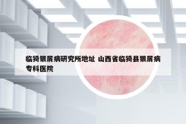 临猗银屑病研究所地址 山西省临猗县银屑病专科医院