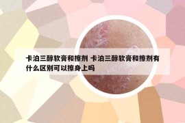 卡泊三醇软膏和擦剂 卡泊三醇软膏和擦剂有什么区别可以擦身上吗