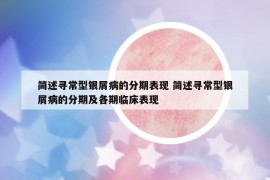 简述寻常型银屑病的分期表现 简述寻常型银屑病的分期及各期临床表现