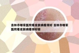 吉林市哪家医院看皮肤病看得好 吉林市哪家医院看皮肤病看得好些