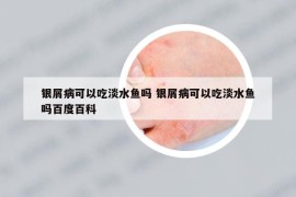 银屑病可以吃淡水鱼吗 银屑病可以吃淡水鱼吗百度百科