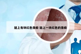 腿上有块红色像癣 腿上一块红色的像癣