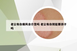 老公有白癜风会介意吗 老公有白斑能要孩子吗